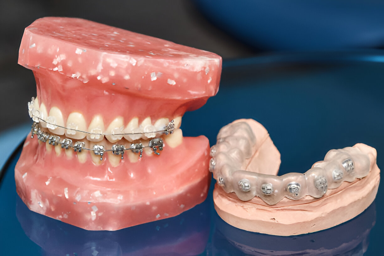 The Price of Neighborhood-Orientated Orthodontic Care in Silver Lake